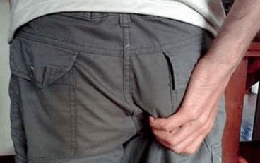 Itching in the anus is a symptom of the presence of parasites