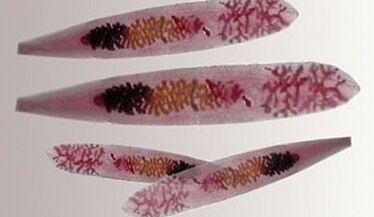 Opisthorchis parasitizes the human body
