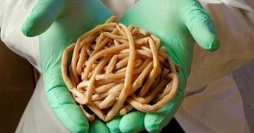 Parasites are extracted from the human body