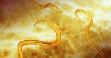 Pinworm parasites in the human body