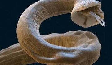Roundworm parasites in the human body