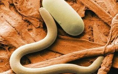 types of parasites exposed in the human body