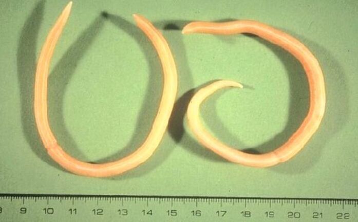 Pinworms from the human body