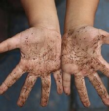 Dirty hands are the cause of worms in children