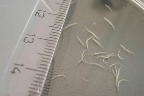 how to remove pinworms from a child