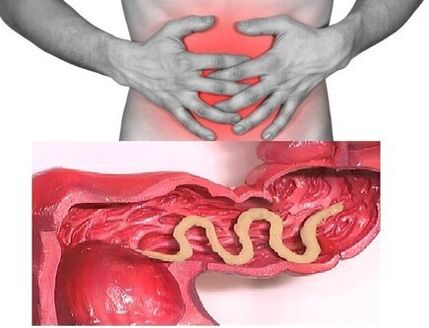 A sign of chronic helminthiasis is an indigestible digestive disorder