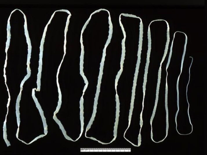 Bovine tapeworm enters people through beef