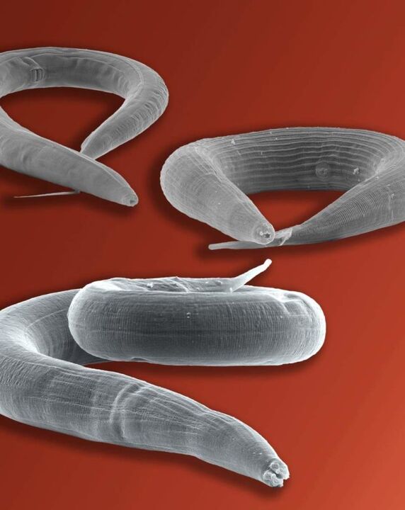 Pinworm parasites live in the intestines