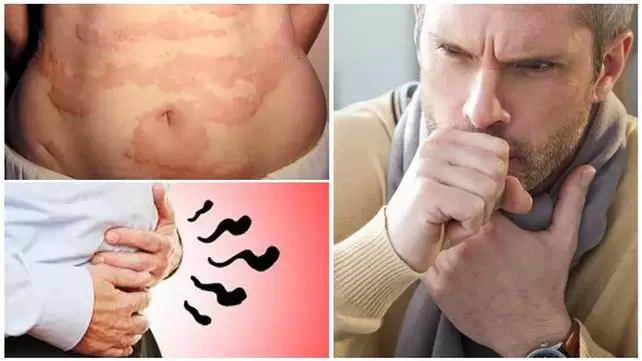Allergies, cough and bloating are signs that the body has harmful worms