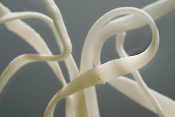 Roundworms are roundworms, belonging to the order nematodes