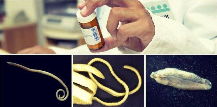 Types of worms and drug treatment methods
